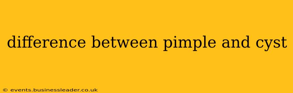 difference between pimple and cyst