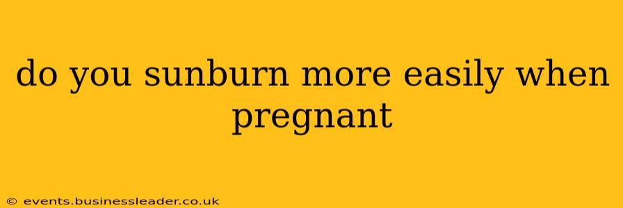 do you sunburn more easily when pregnant