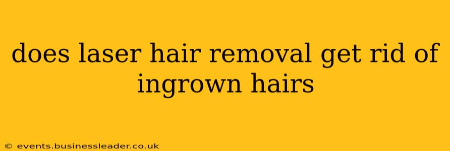 does laser hair removal get rid of ingrown hairs