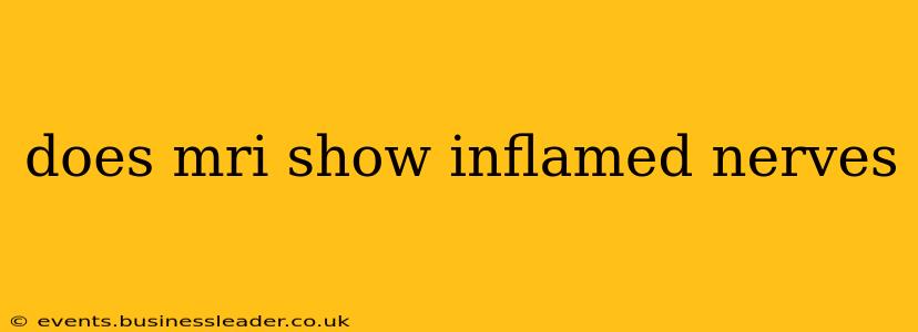 does mri show inflamed nerves