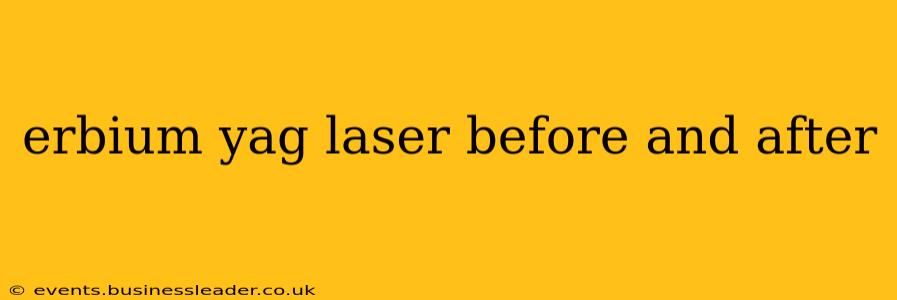 erbium yag laser before and after