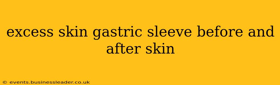 excess skin gastric sleeve before and after skin