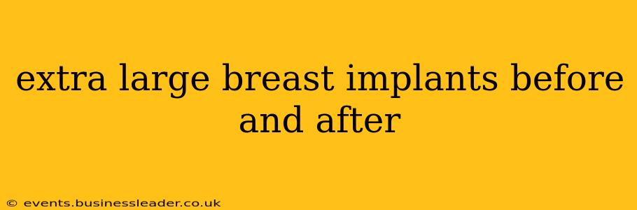 extra large breast implants before and after
