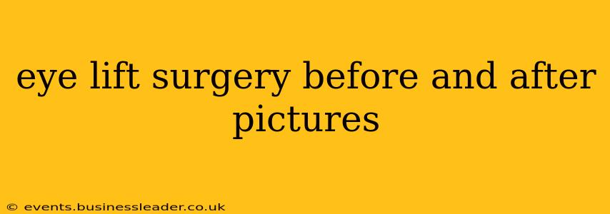 eye lift surgery before and after pictures