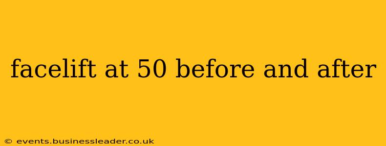facelift at 50 before and after