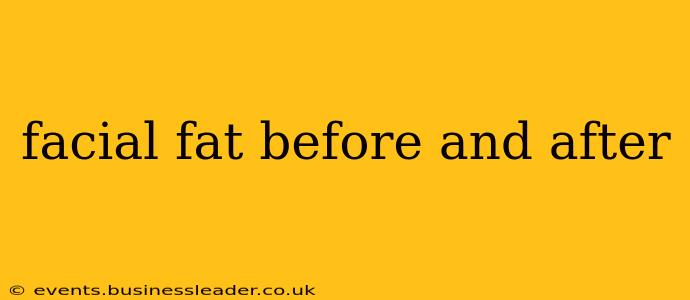 facial fat before and after