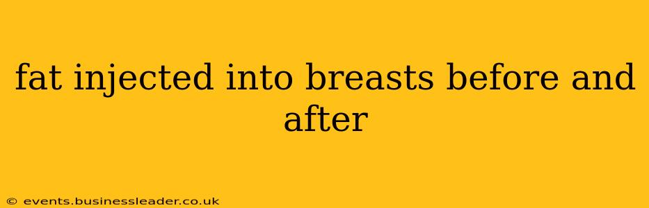 fat injected into breasts before and after
