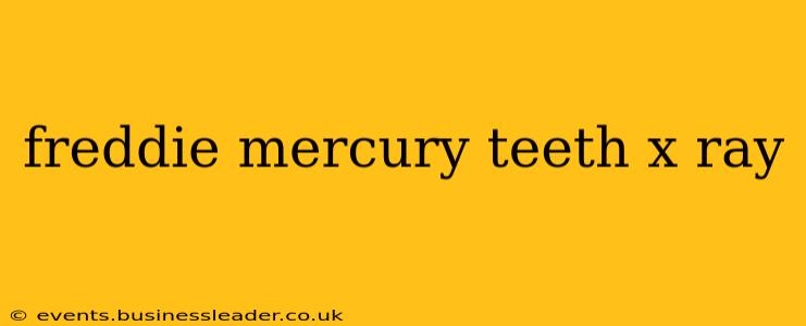 freddie mercury teeth x ray