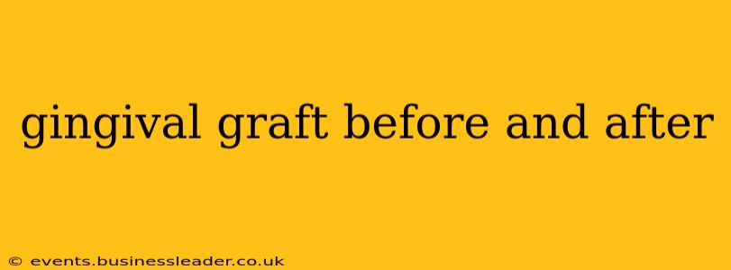 gingival graft before and after