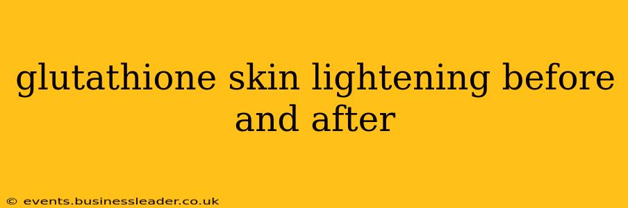 glutathione skin lightening before and after