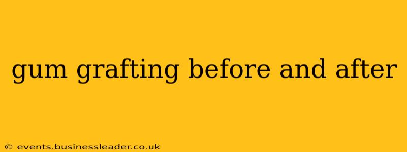 gum grafting before and after