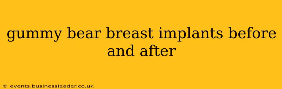 gummy bear breast implants before and after