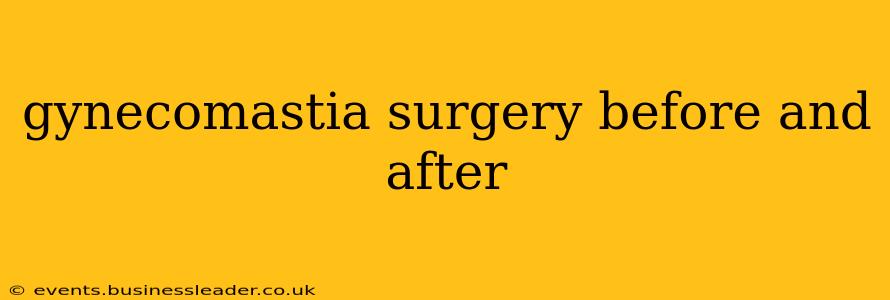 gynecomastia surgery before and after