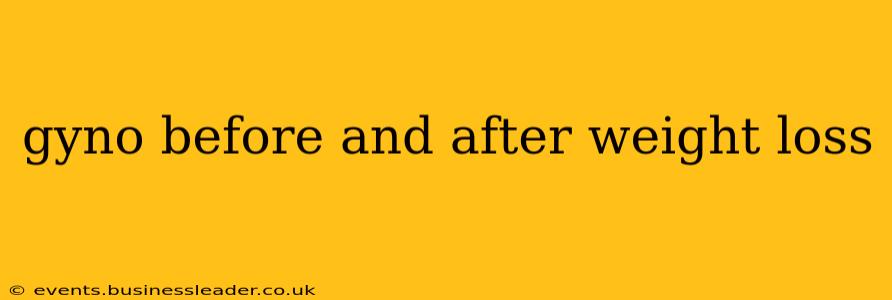 gyno before and after weight loss