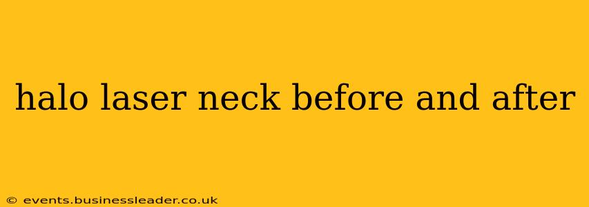 halo laser neck before and after