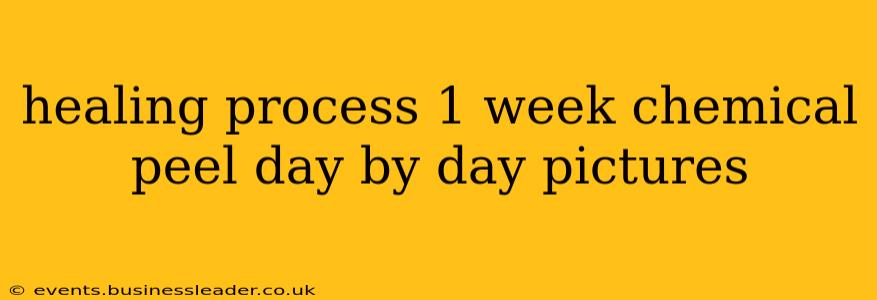 healing process 1 week chemical peel day by day pictures