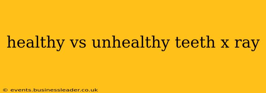 healthy vs unhealthy teeth x ray