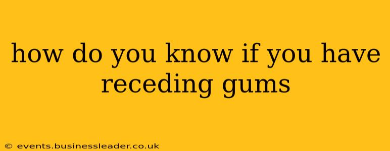 how do you know if you have receding gums