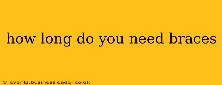 how long do you need braces