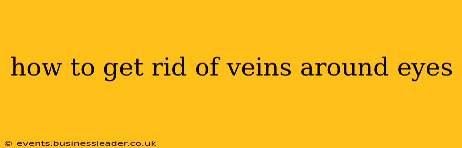 how to get rid of veins around eyes