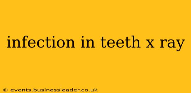 infection in teeth x ray