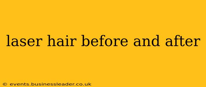 laser hair before and after