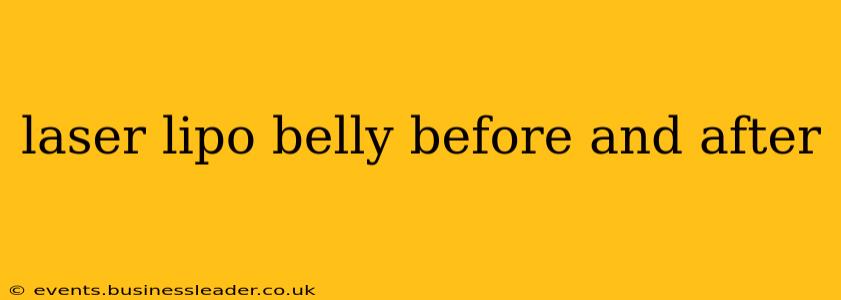laser lipo belly before and after