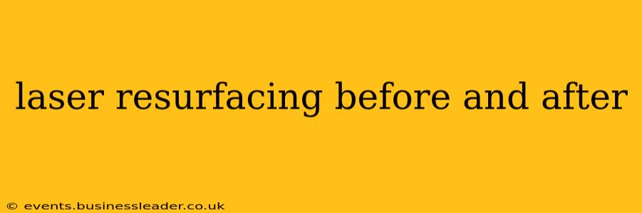 laser resurfacing before and after