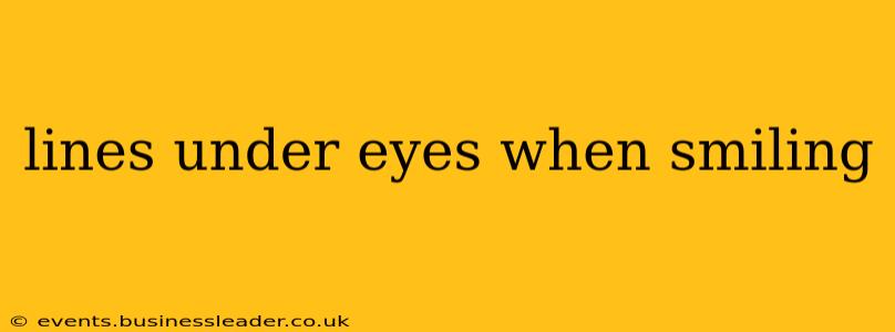 lines under eyes when smiling