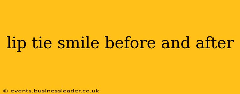lip tie smile before and after
