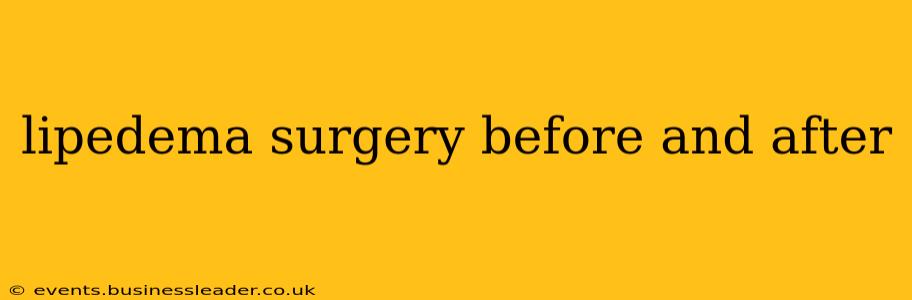 lipedema surgery before and after