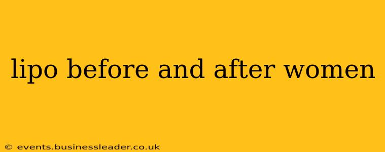 lipo before and after women