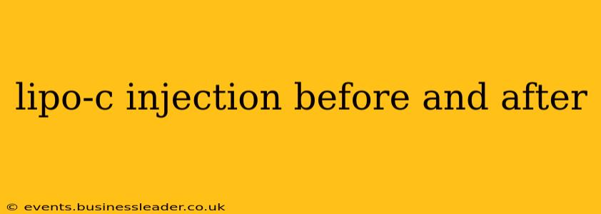 lipo-c injection before and after
