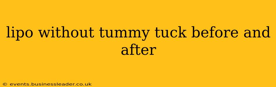 lipo without tummy tuck before and after
