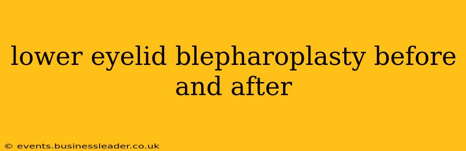 lower eyelid blepharoplasty before and after