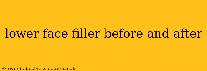 lower face filler before and after