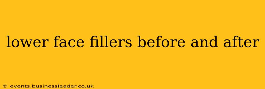 lower face fillers before and after
