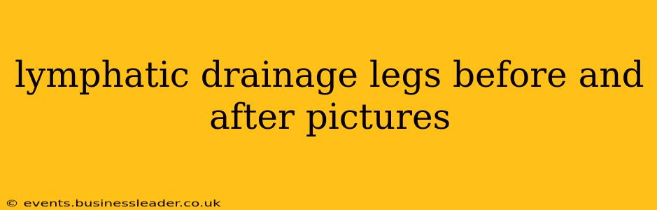 lymphatic drainage legs before and after pictures