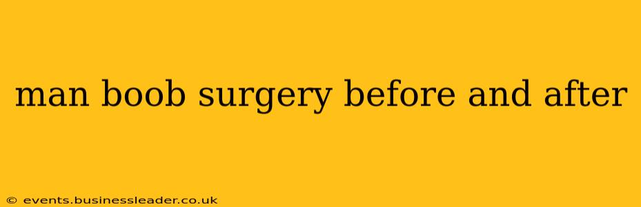 man boob surgery before and after