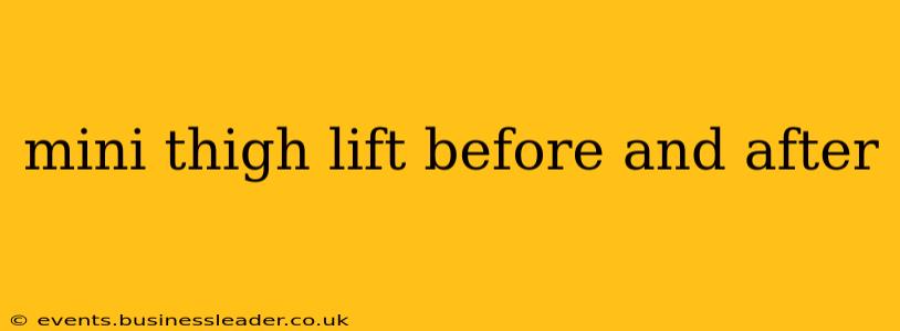 mini thigh lift before and after