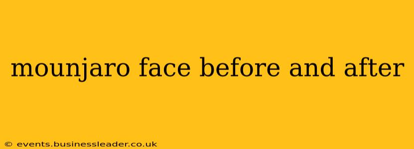 mounjaro face before and after