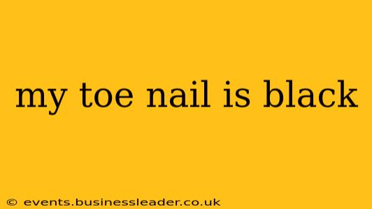 my toe nail is black