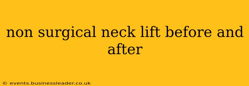 non surgical neck lift before and after