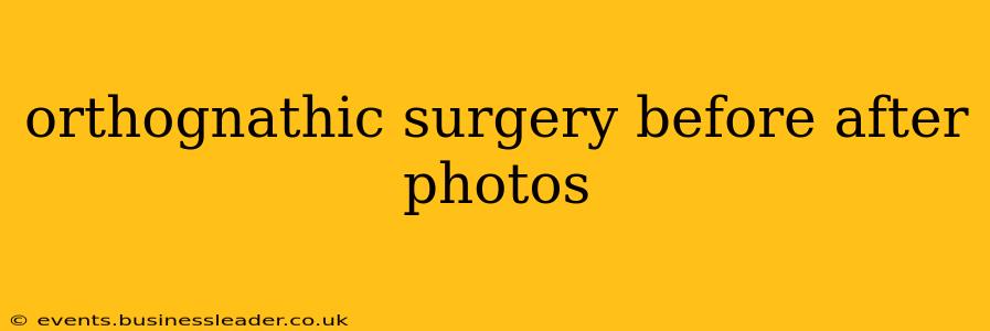 orthognathic surgery before after photos