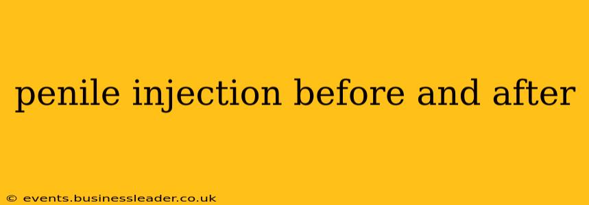 penile injection before and after