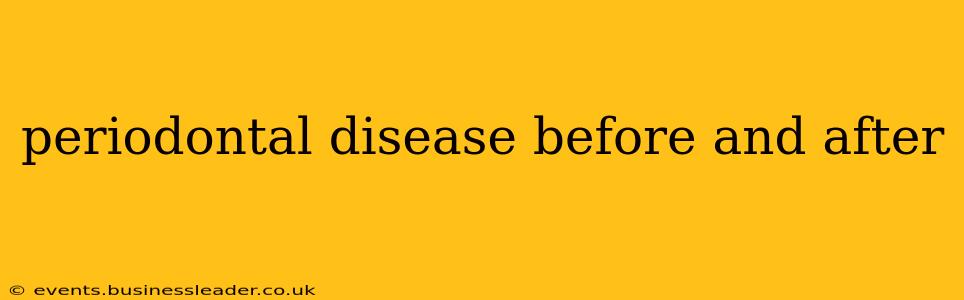 periodontal disease before and after