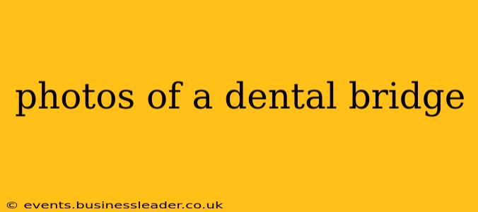 photos of a dental bridge