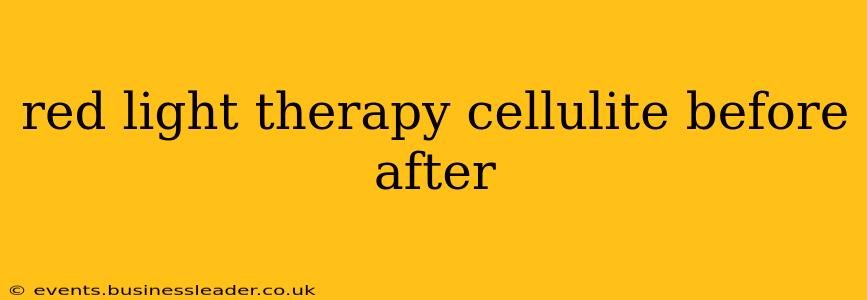 red light therapy cellulite before after