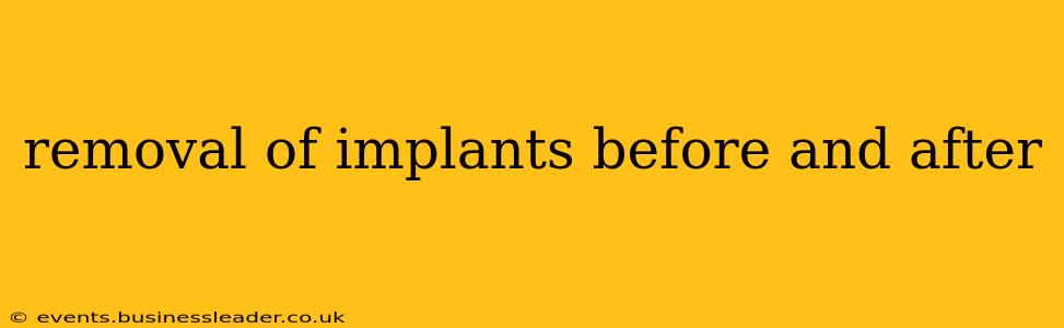 removal of implants before and after
