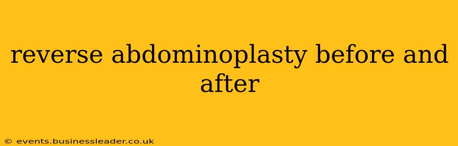 reverse abdominoplasty before and after